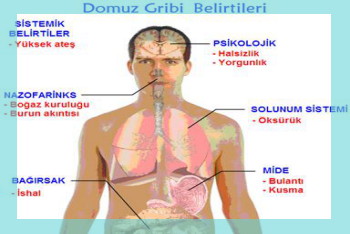 domuz gribi